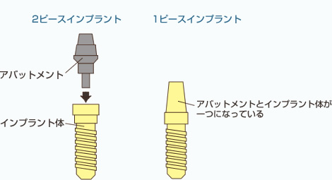 1ピースと2ピースの違い
